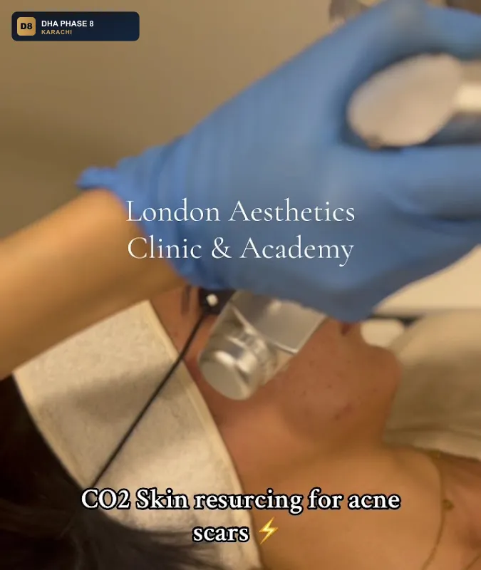 london-aesthetics-clinic-training-academy-dha-phase-8-karachi thumb 2