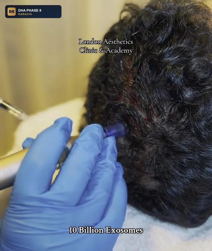 london-aesthetics-clinic-training-academy-dha-phase-8-karachi thumb 3