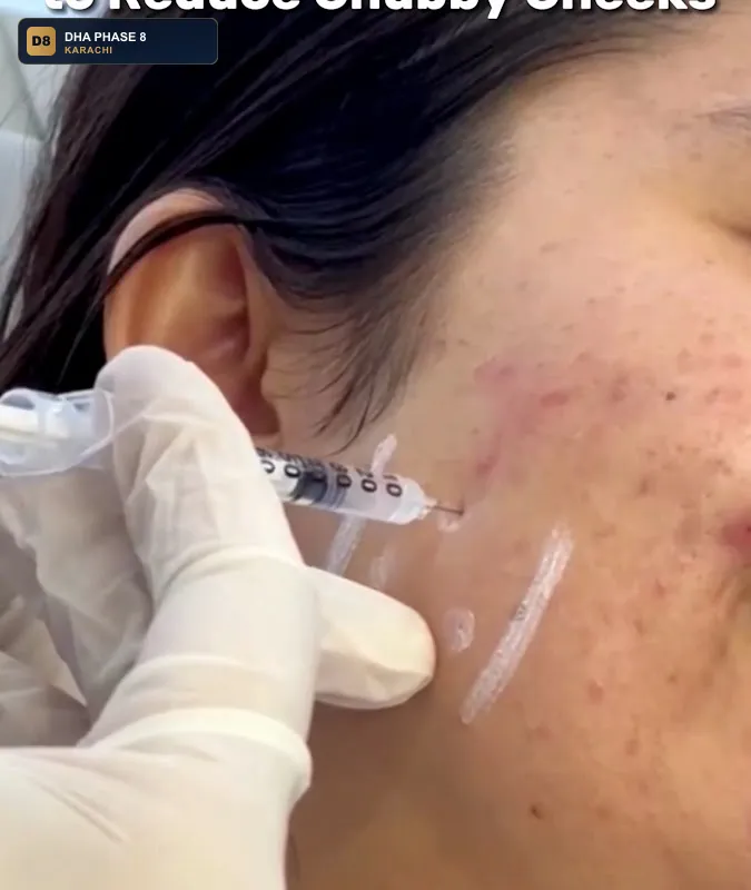 dna-asthetic-laser-clinic-in-dha-karachi-dha-phase-8-karachi thumb 2