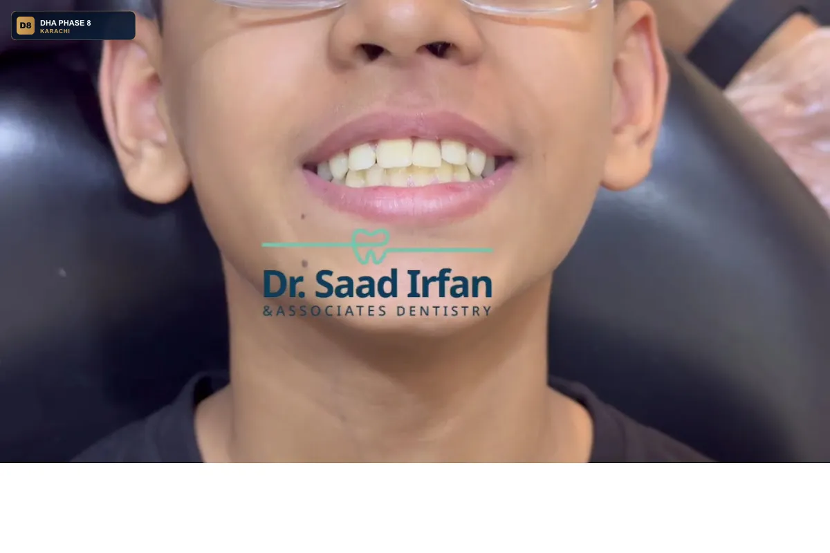 dr-saad-irfan-associates-dentistry-dha-phase-8-dha-phase-8-karachi thumb 3