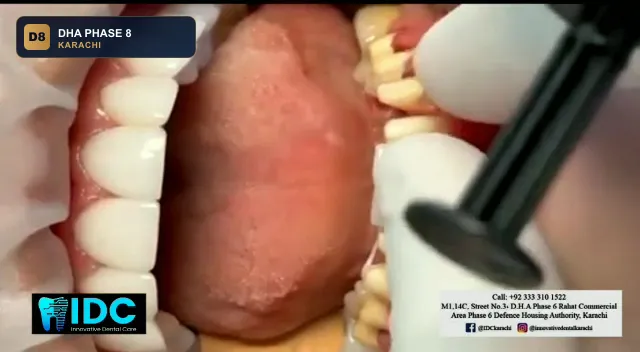 innovative-dental-care-karachi-dha-phase-8-karachi thumb 3